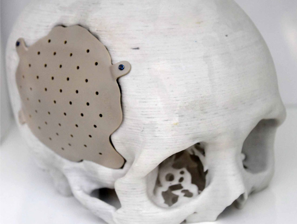 �@������ɫ�ĸ�ˎ��������Ŀ��������3D��ӡ���XĤ��